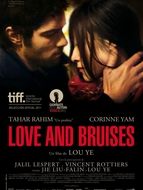 Love And Bruises